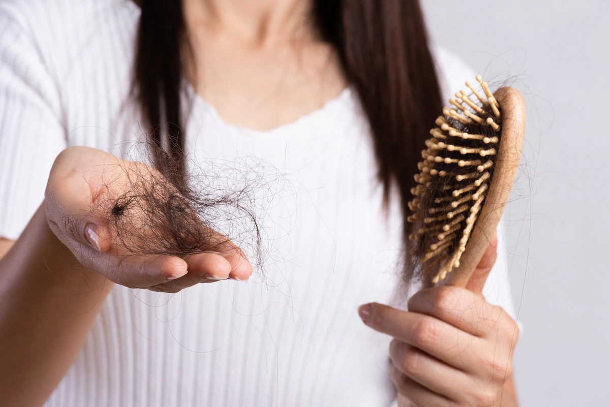 What Causes Hair Loss?
