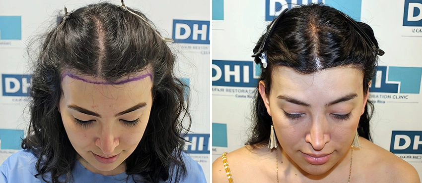 Square IMG_3814-1024x683-topaz-enhance-4x