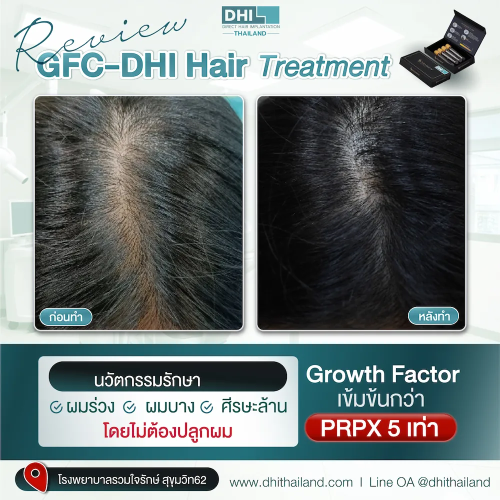 รีวิว_02_0