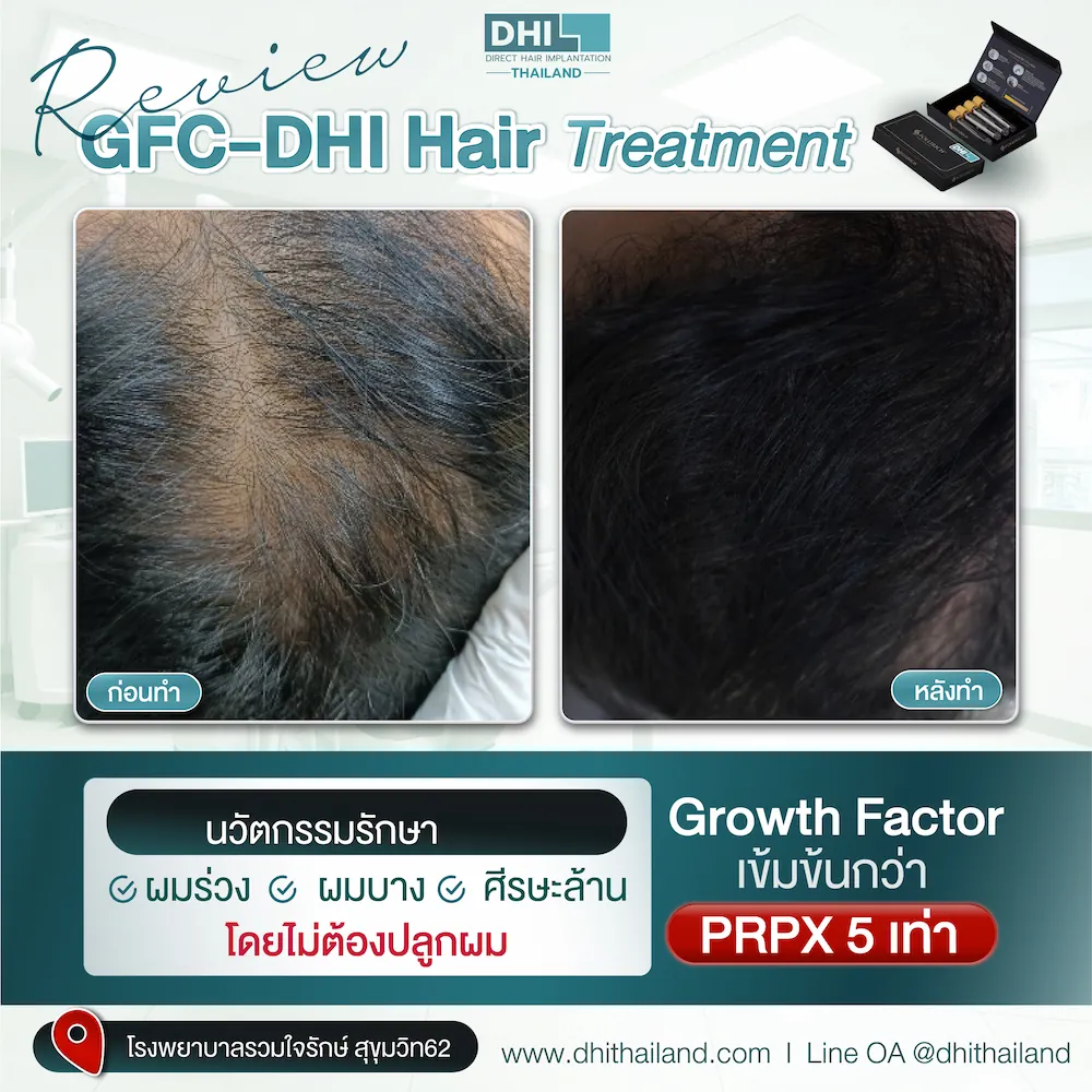 รีวิว_03_0