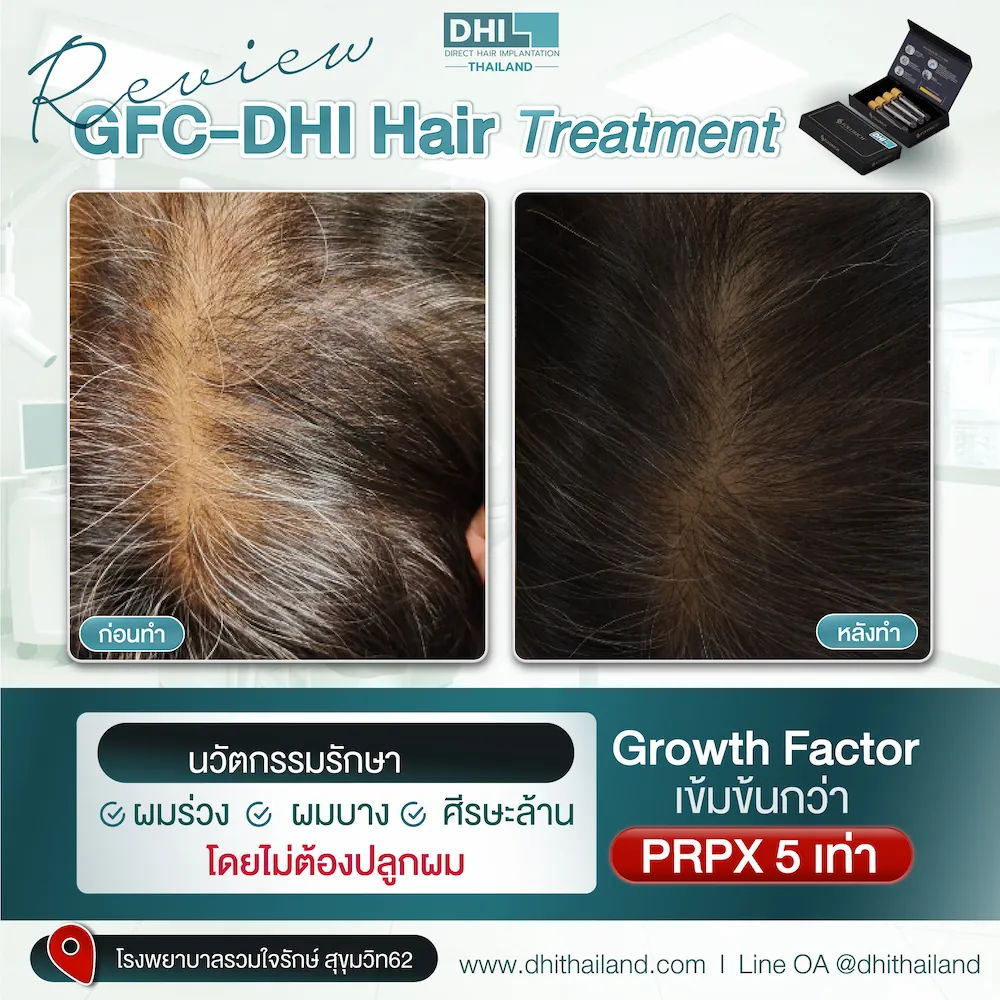 รีวิว_04_0