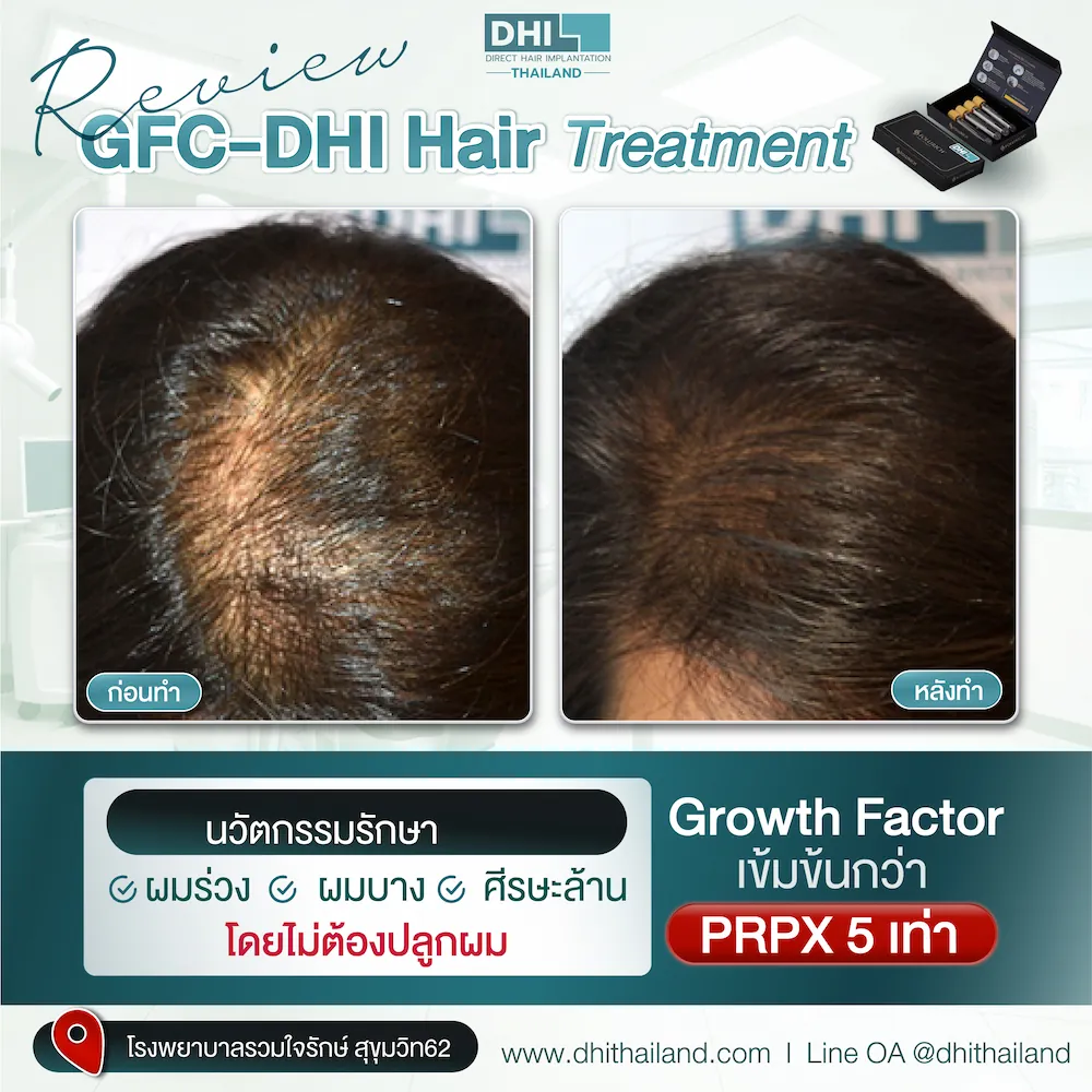 รีวิว_05_0