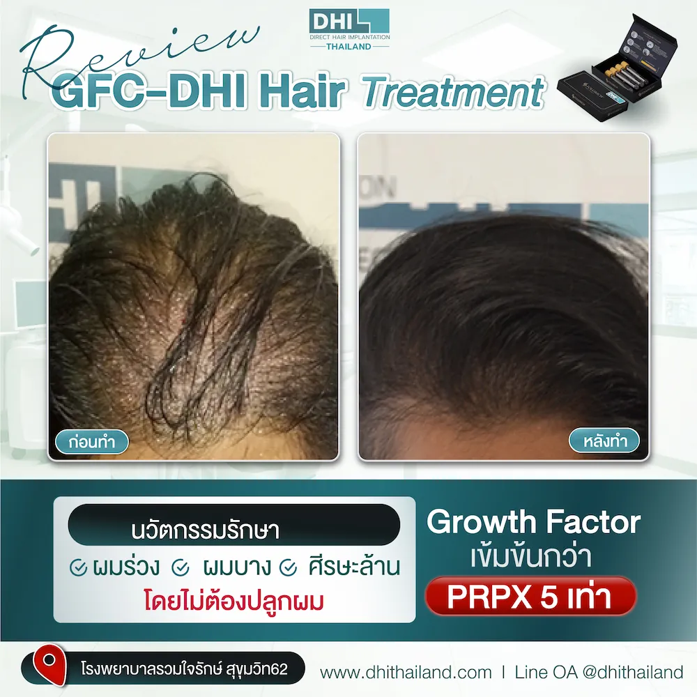 รีวิว_06_0