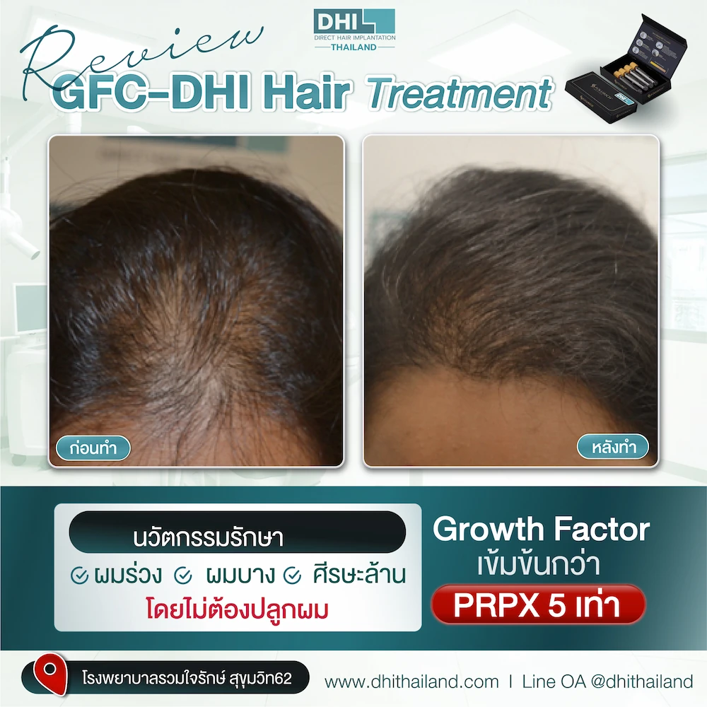 รีวิว_07_0