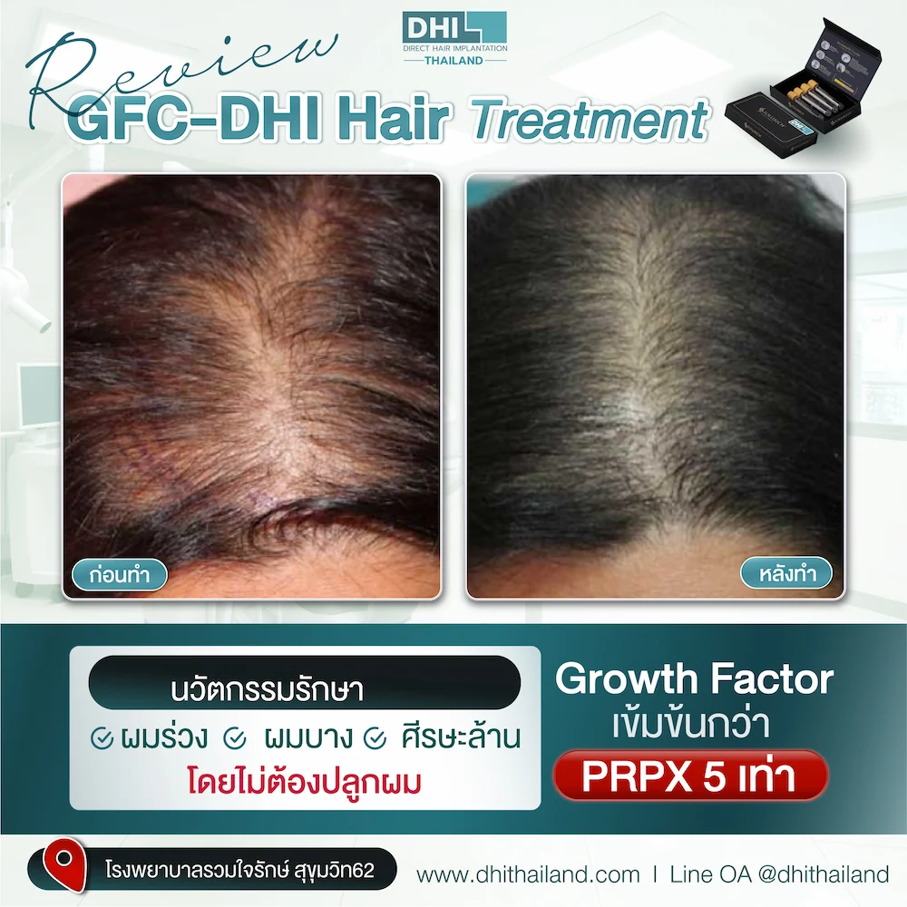 รีวิว_08_0