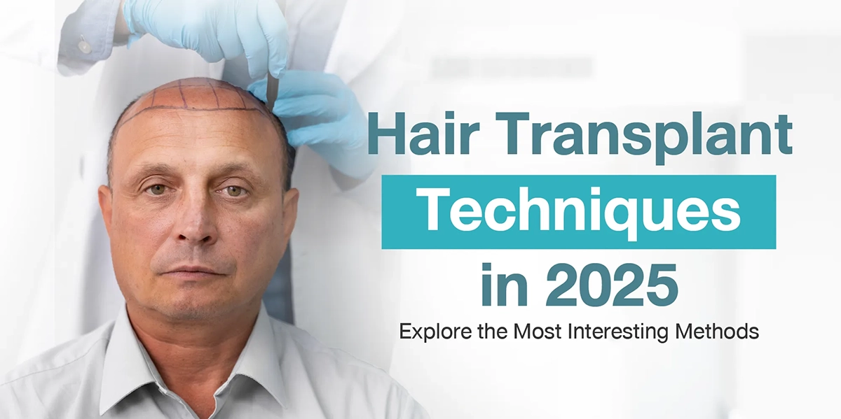 Hair Transplant Techniques in 2025