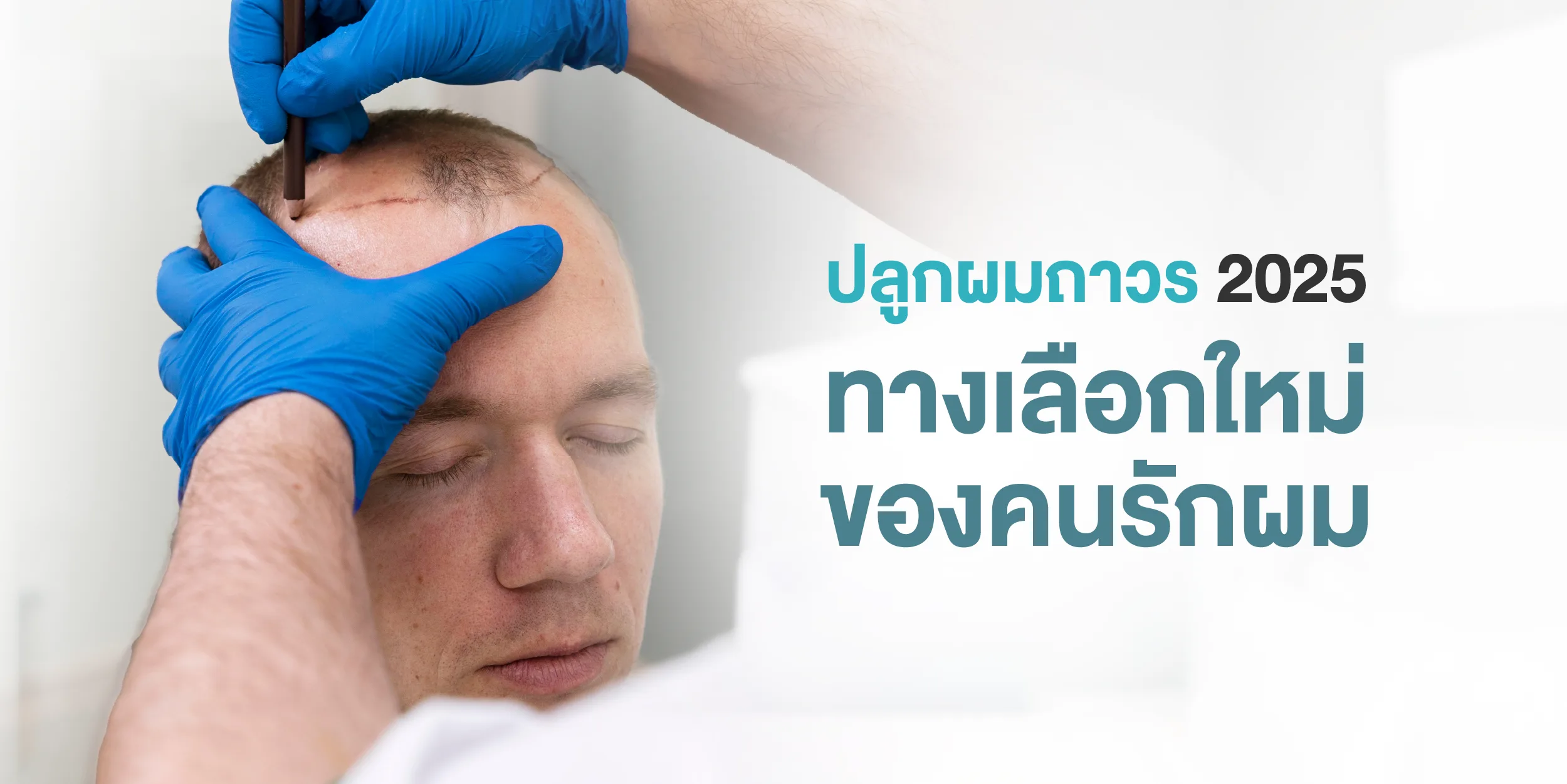 ปลูกผมถาวร 2025