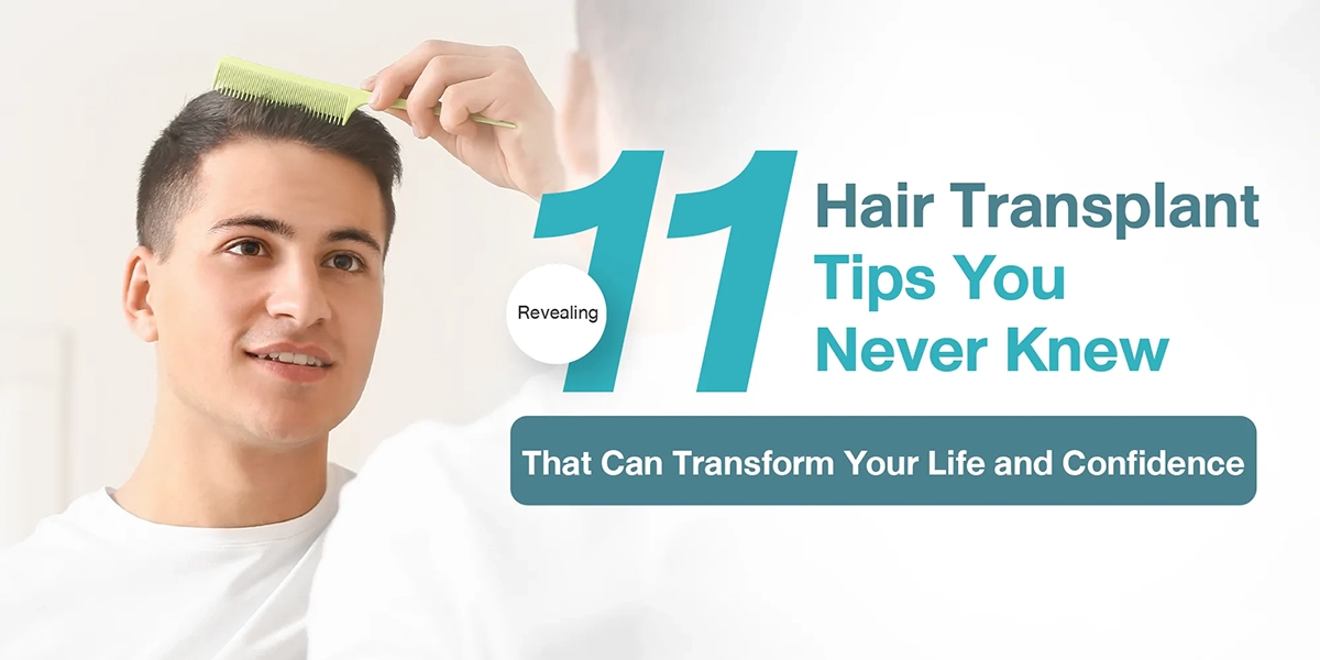 Revealing 11 Hair Transplant Tips You Never Knew That Can Transform Your Life and Confidence