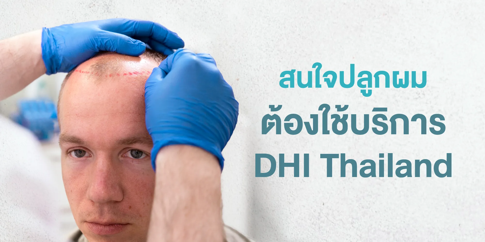 สนใจปลูกผมต้องใช้บริการ DHI Thailand