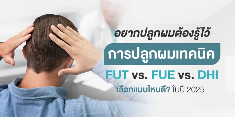อยากปลูกผมต้องรู้ไว้ การปลูกผมเทคนิค FUT vs. FUE vs. DHI เลือกแบบไหนดี? ในปี 2025