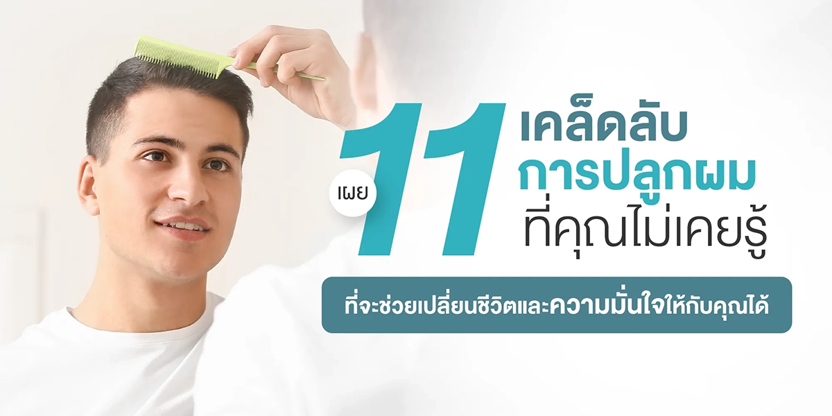 เผย 11 เคล็ดลับการปลูกผม ที่คุณไม่เคยรู้ที่จะช่วยเปลี่ยนชีวิตและความมั่นใจให้กับคุณได้
