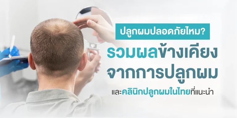 ปลูกผมปลอดภัยไหม? รวมผลข้างเคียงจากการปลูกผม และคลินิกปลูกผมในไทยที่แนะนำ