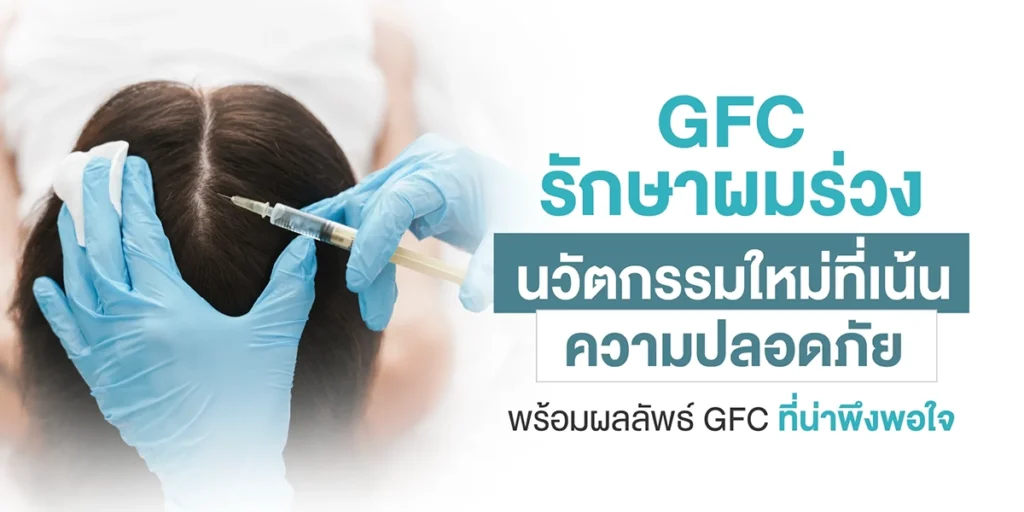 GFC รักษาผมร่วง นวัตกรรมใหม่ที่เน้นความปลอดภัย พร้อมผลลัพธ์ GFC ที่น่าพึงพอใจ