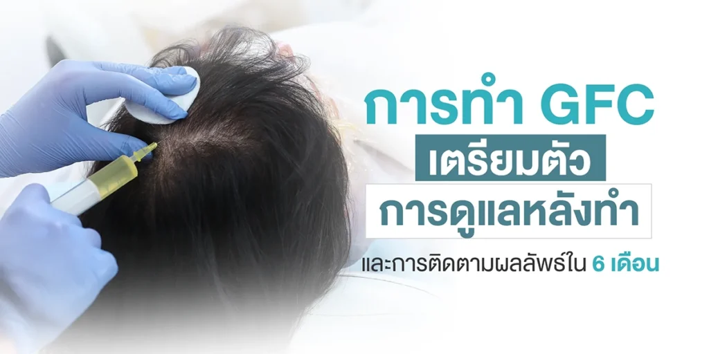 การทำ GFC เตรียมตัว, การดูแลหลังทำ, และการติดตามผลลัพธ์ใน 6 เดือน