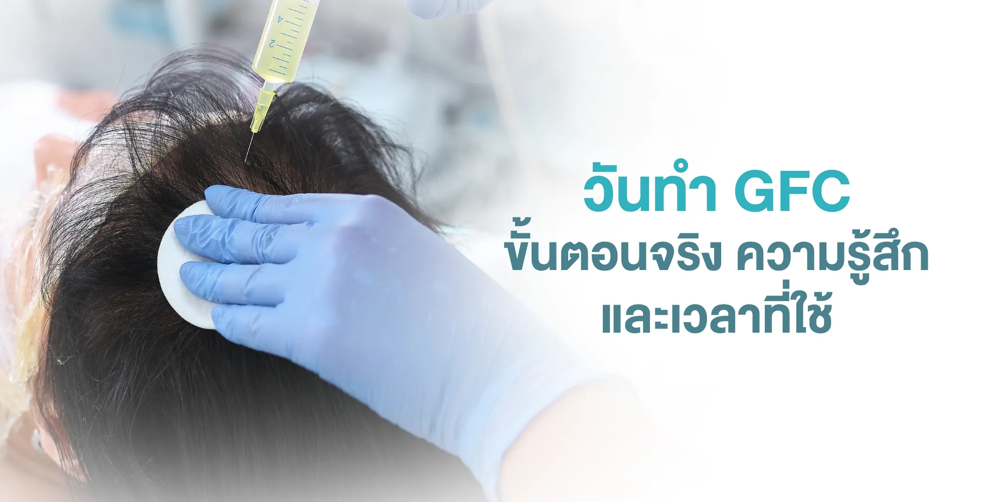 วันทำ GFC ขั้นตอนจริง ความรู้สึก และเวลาที่ใช้