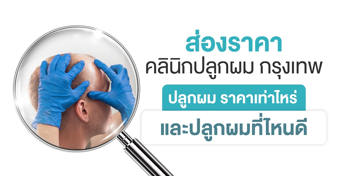 ส่องราคาคลินิกปลูกผม กรุงเทพ ปลูกผม ราคาเท่าไหร่ และปลูกผมที่ไหนดี