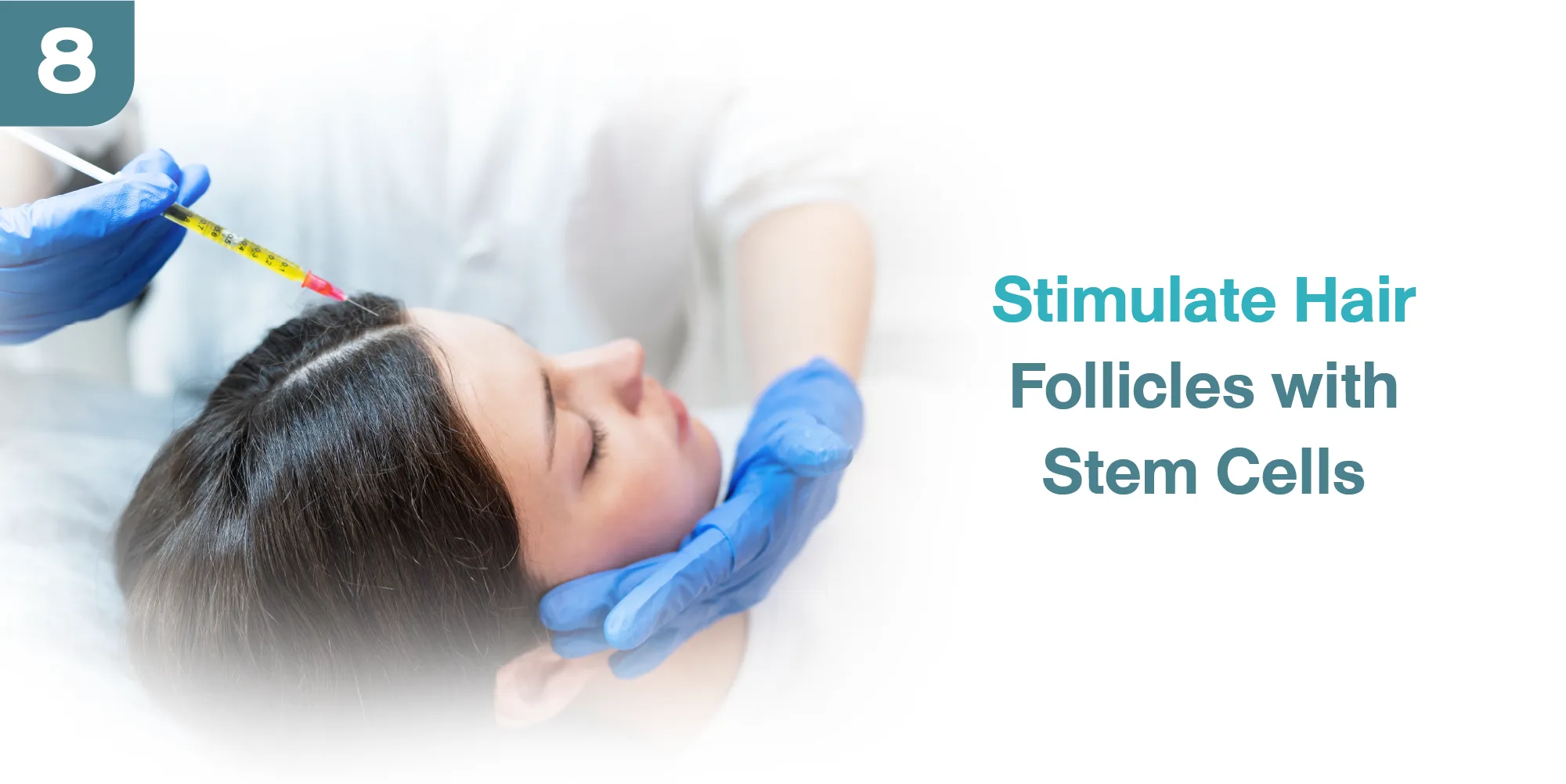 Stimulate Hair Follicles with Stem Cells