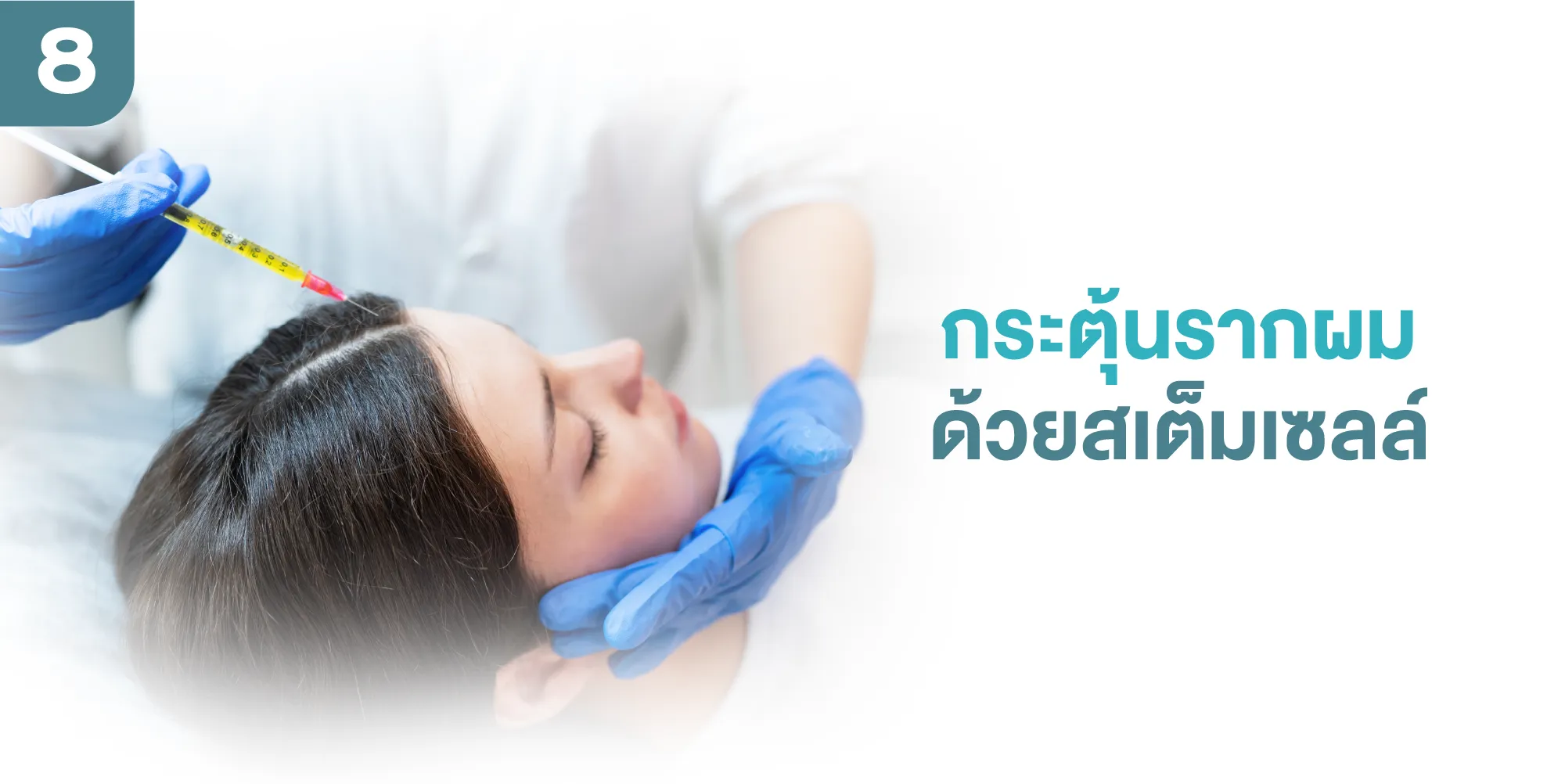 กระตุ้นรากผมด้วยสเต็มเซลล์