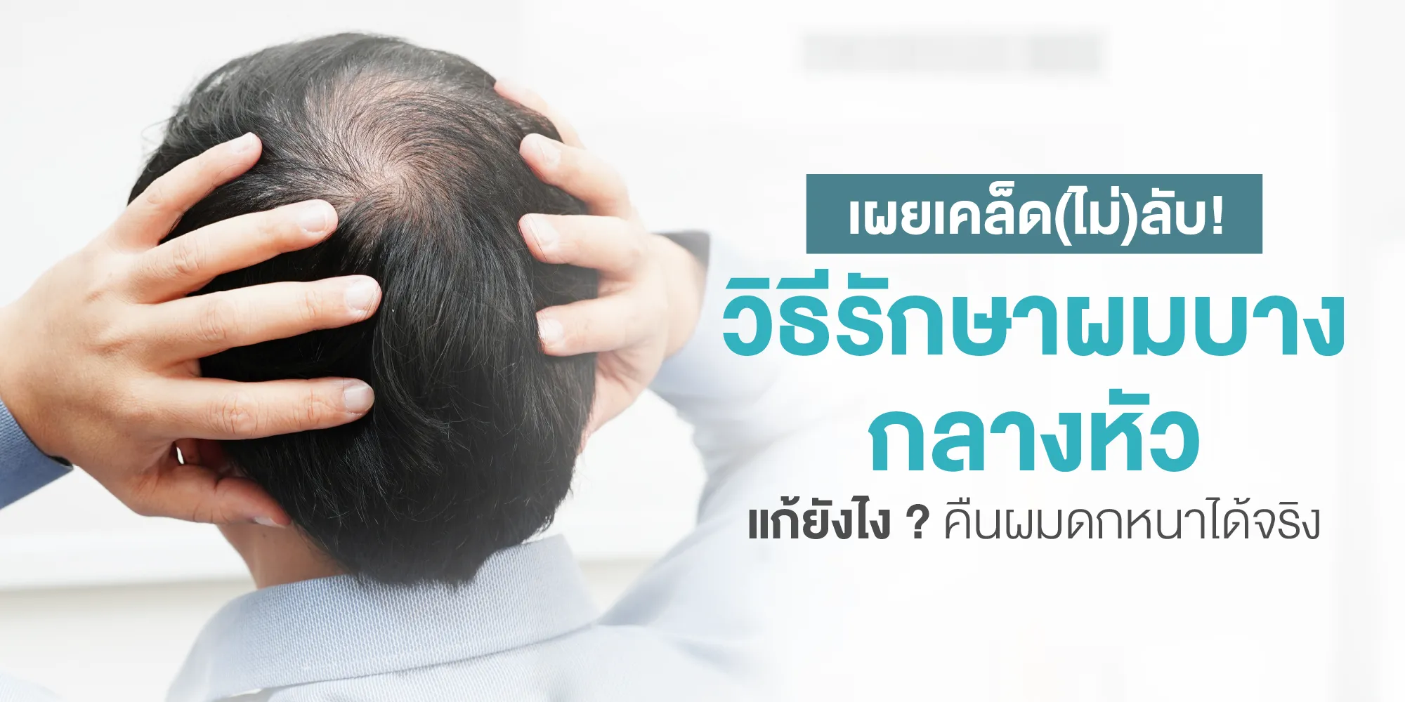 เผยเคล็ด(ไม่)ลับ! วิธีรักษาผมบางกลางหัว แก้ยังไง คืนผมดกหนาได้จริง