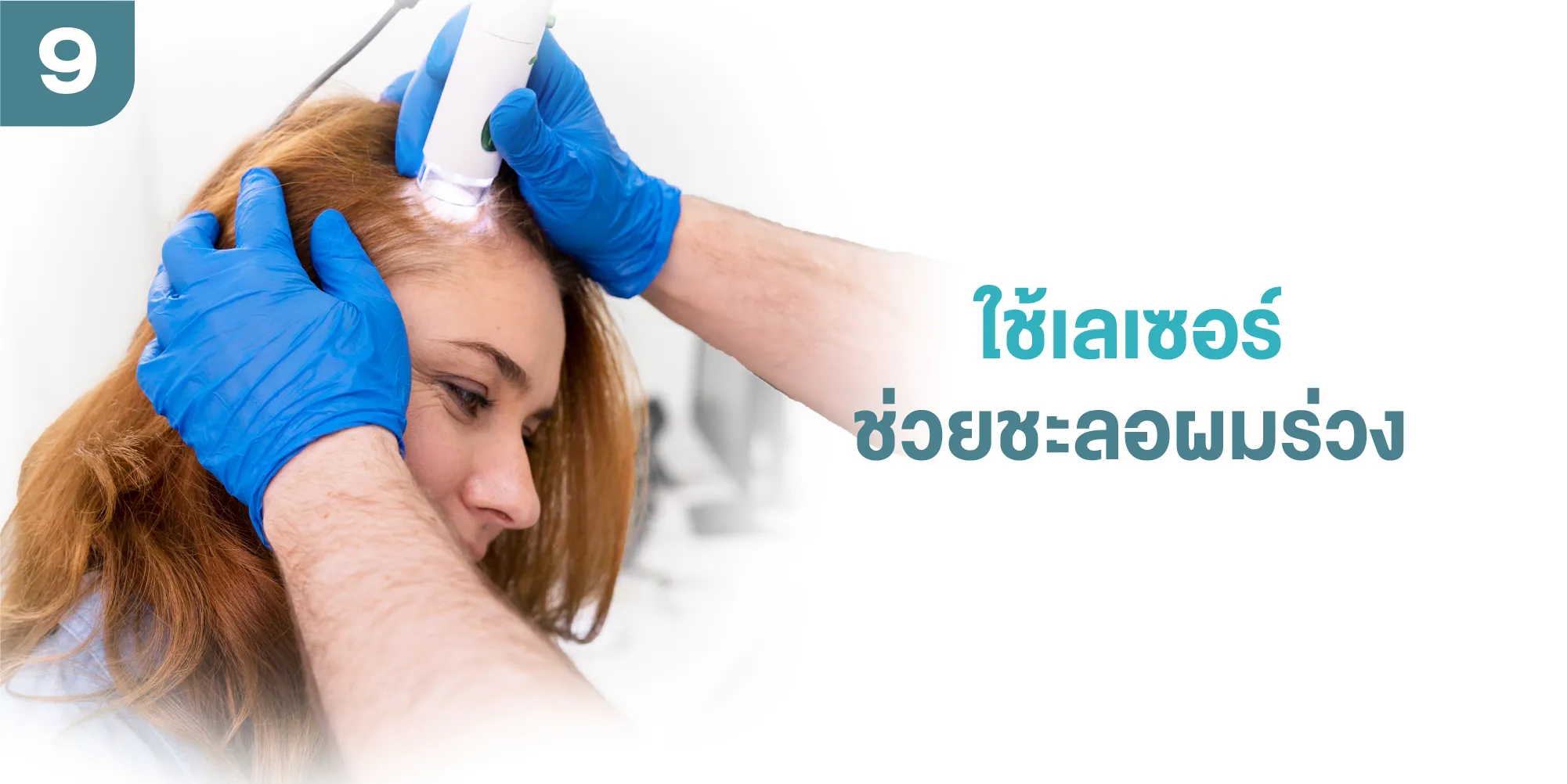 ใช้เลเซอร์ช่วยชะลอผมร่วง