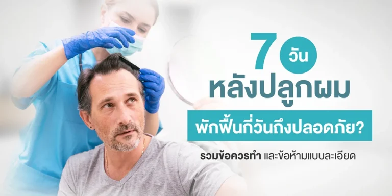 7 วันหลังปลูกผม พักฟื้นกี่วันถึงปลอดภัย? รวมข้อควรทำ และข้อห้ามแบบละเอียด