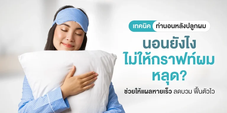 เทคนิคท่านอนหลังปลูกผม นอนยังไงไม่ให้กราฟท์ผมหลุด? ช่วยให้แผลหายเร็ว ลดบวม ฟื้นตัวไว