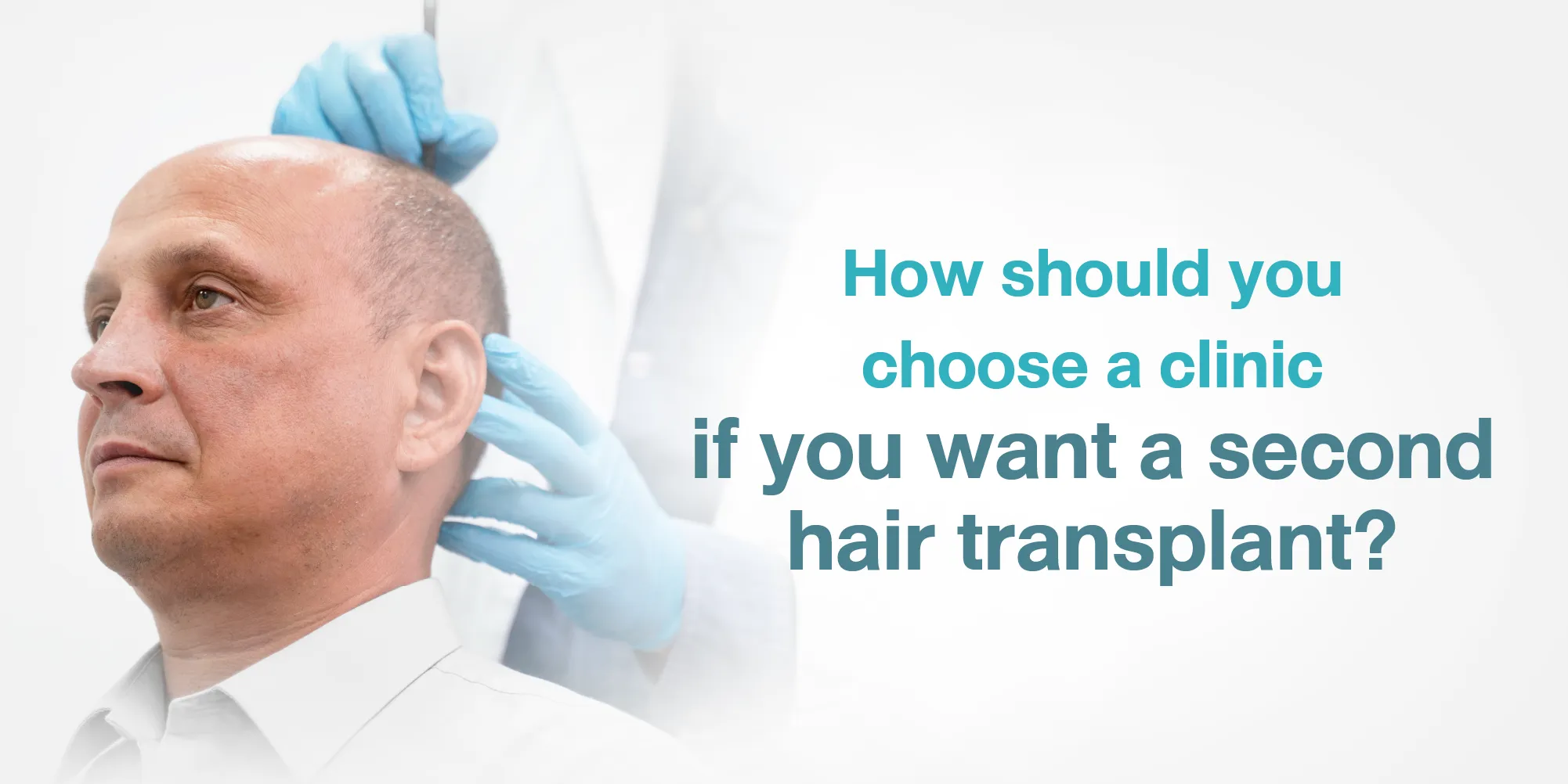 How should you choose a clinic if you want a second hair transplant