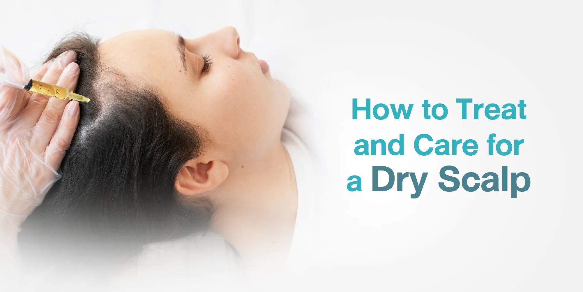 How to Treat and Care for a Dry Scalp