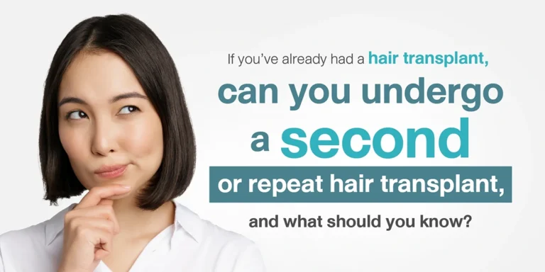Can You Get a Second Hair Transplant? What to Know