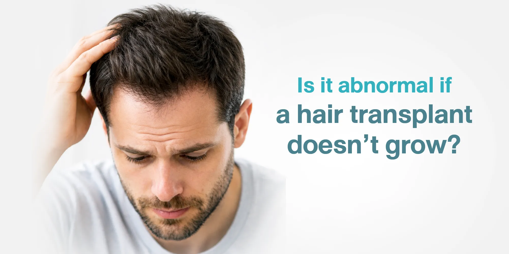 Is it abnormal if a hair transplant doesn’t grow