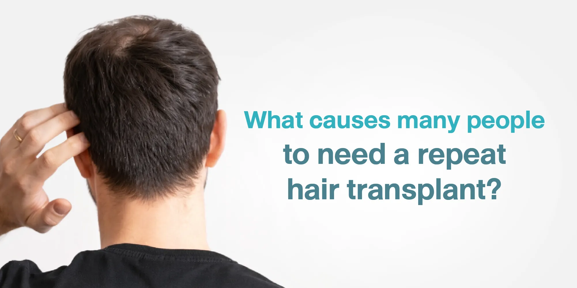 What causes many people to need a repeat hair transplant