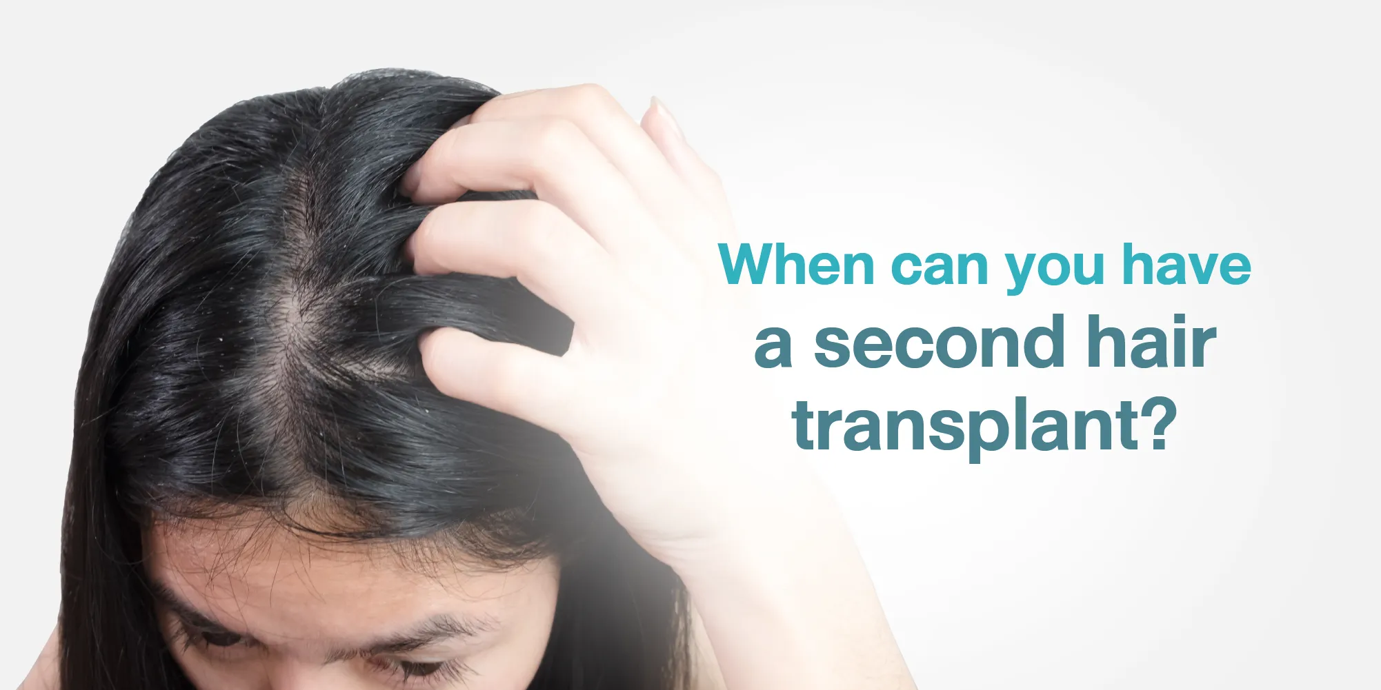 When can you have a second hair transplant