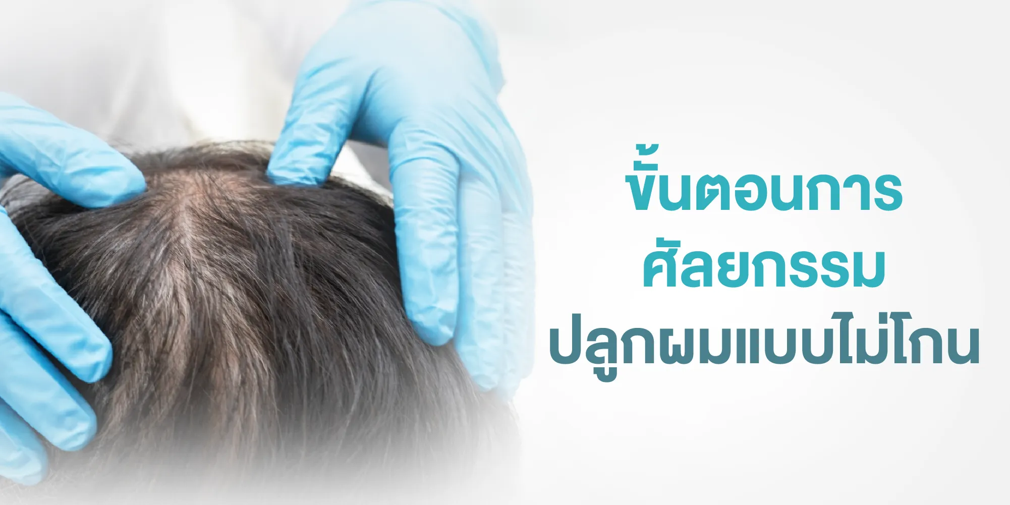 ขั้นตอนการศัลยกรรมปลูกผมแบบไม่โกน