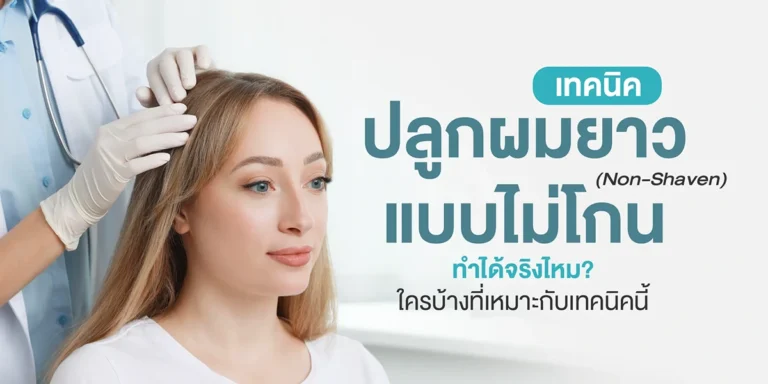 เทคนิคปลูกผมยาวแบบไม่โกน (Non-Shaven) ทำได้จริงไหม? ใครบ้างที่เหมาะกับเทคนิคนี้