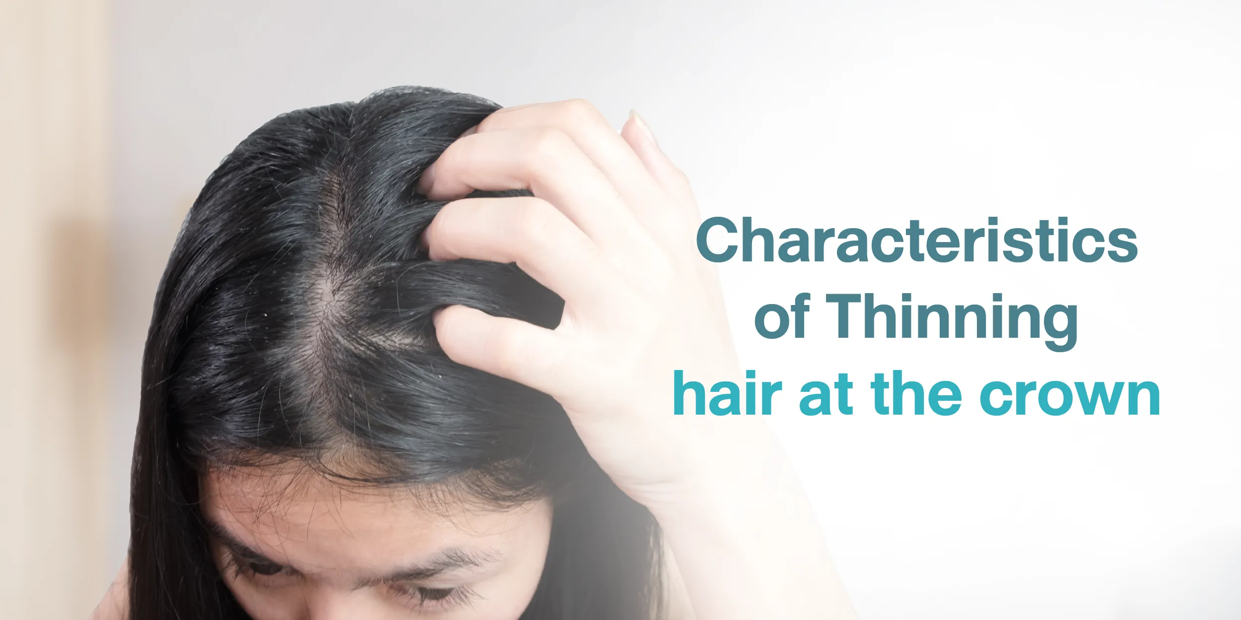 Characteristics of Thinning hair at the crown