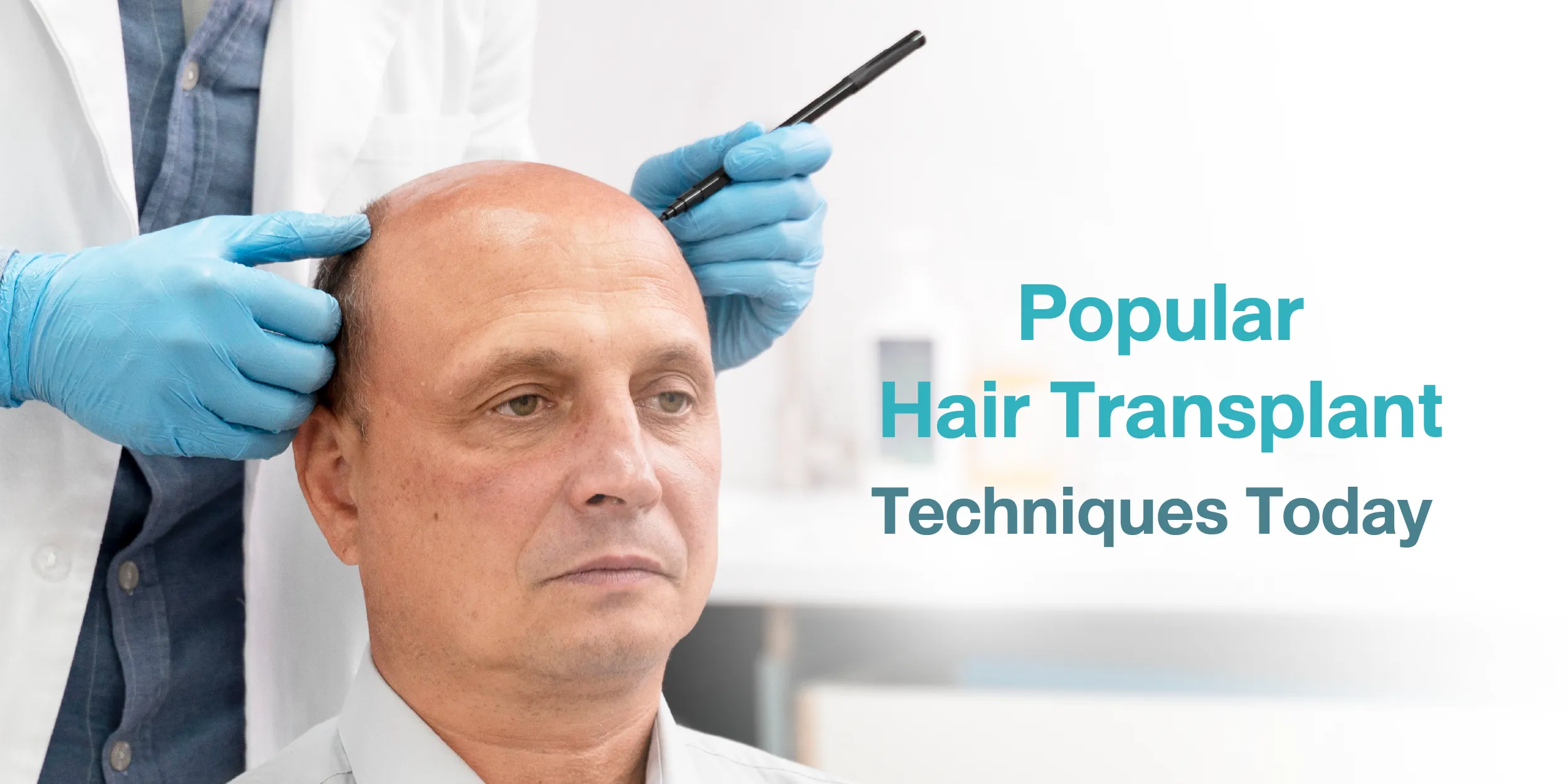 Popular Hair Transplant Techniques Today