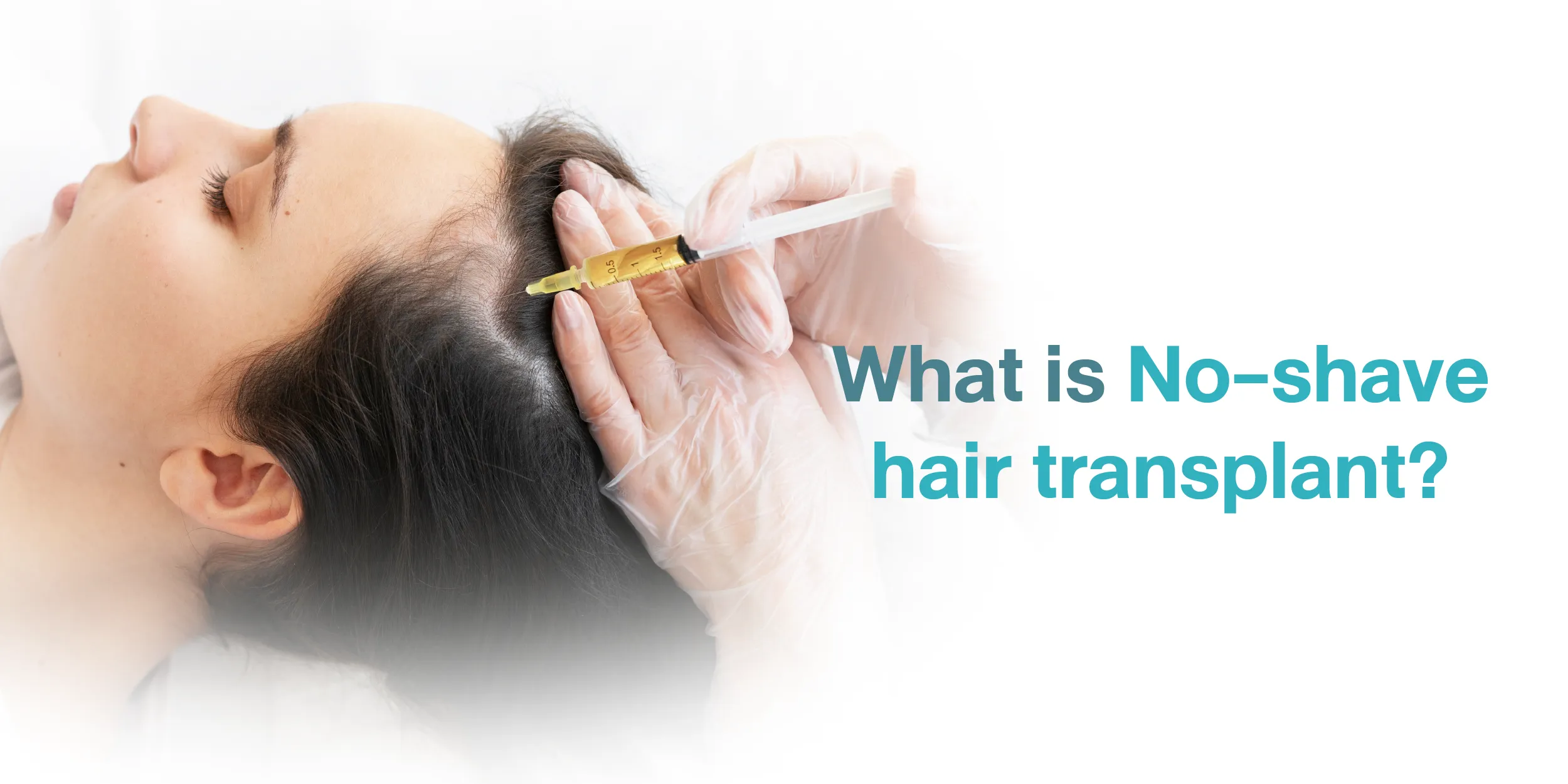 What is No-shave hair transplant