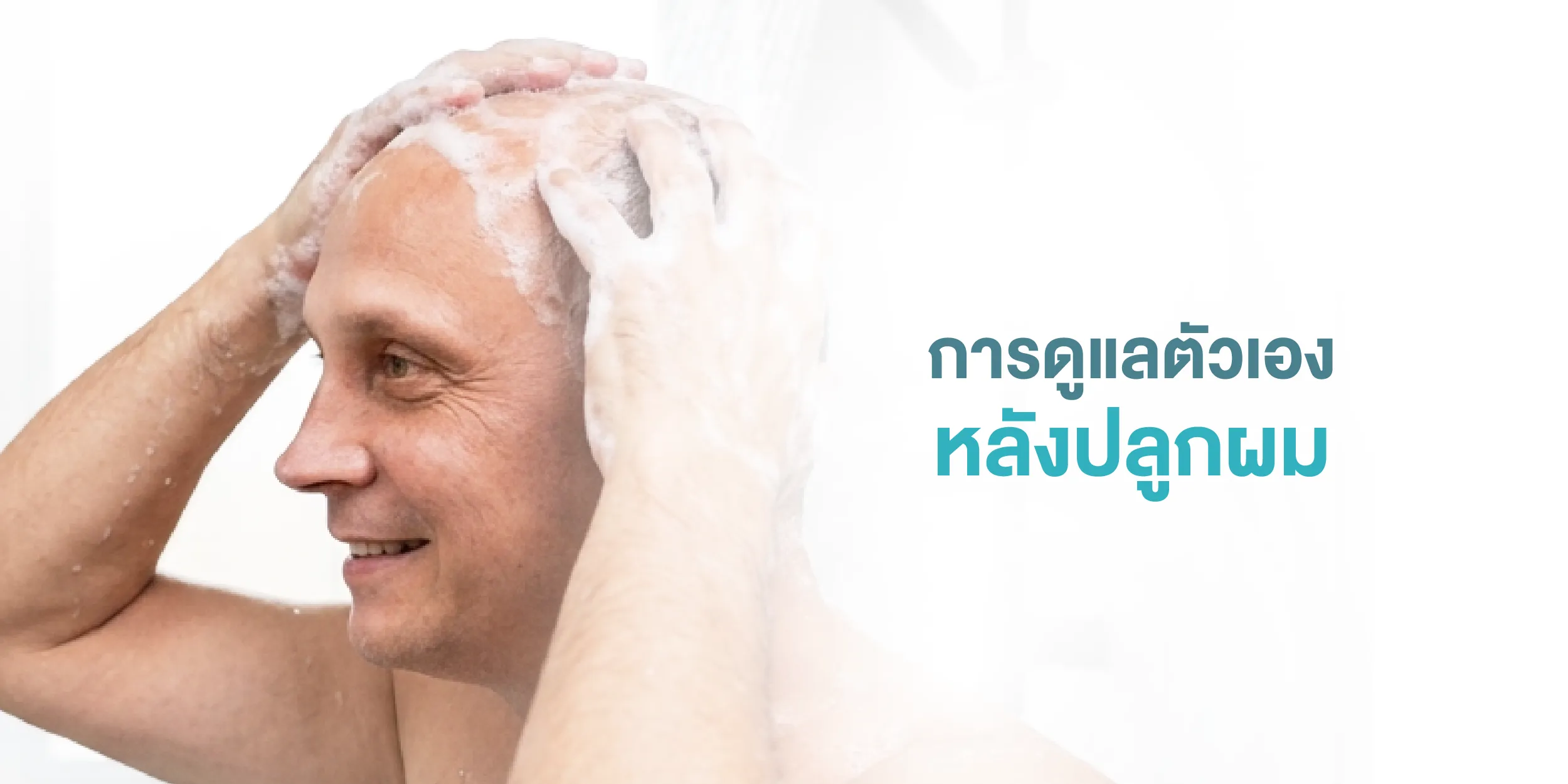 การดูแลตัวเองหลังปลูกผม