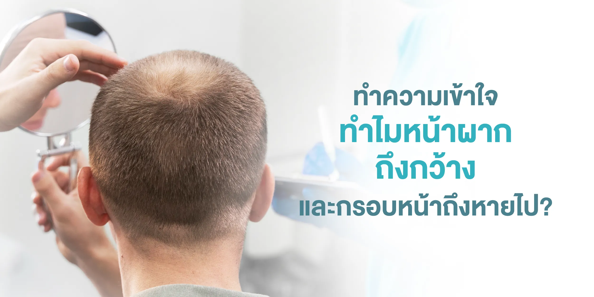 ทำความเข้าใจ ทำไมหน้าผากถึงกว้าง และกรอบหน้าถึงหายไป