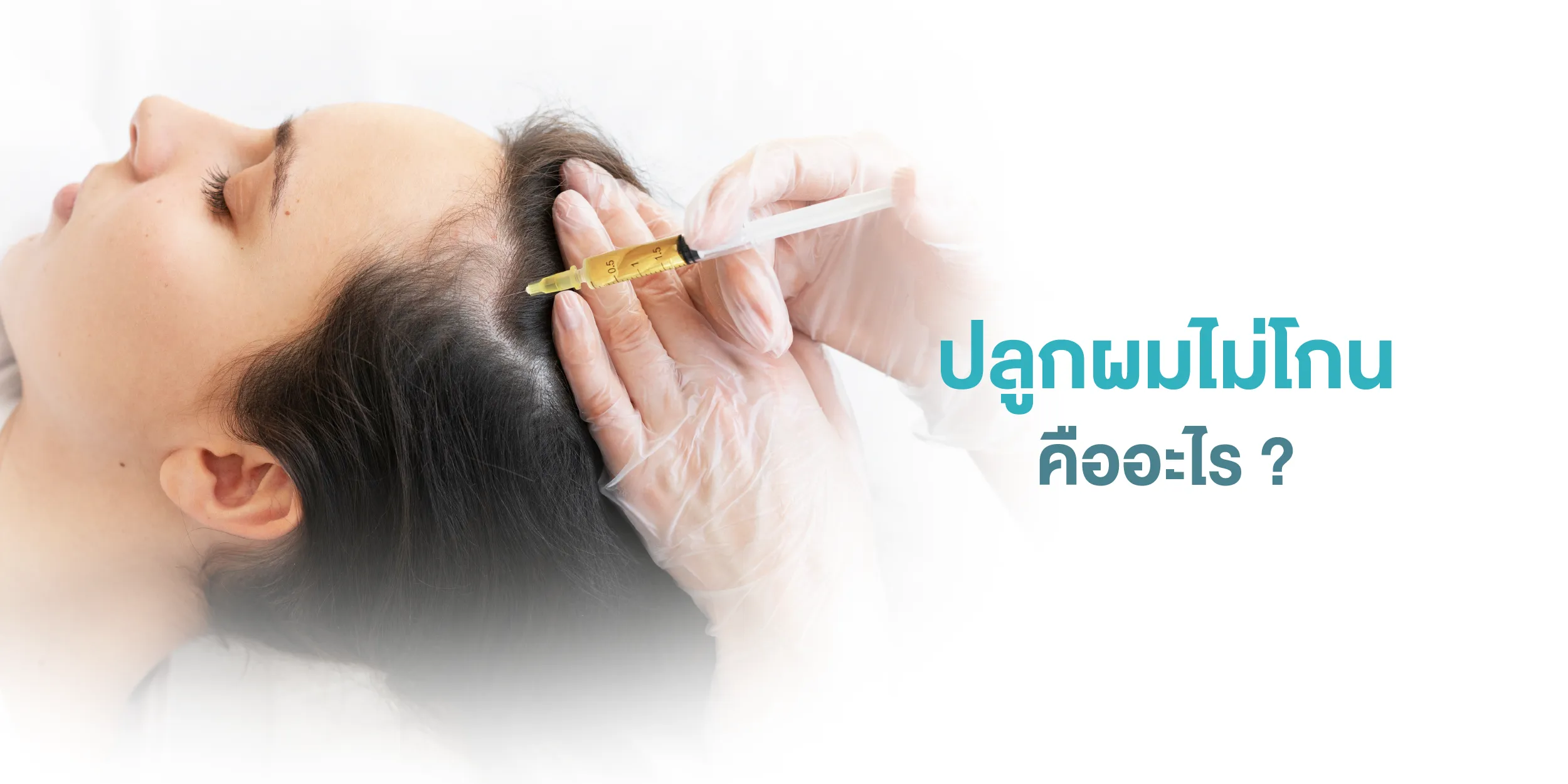 ปลูกผมไม่โกน คืออะไร