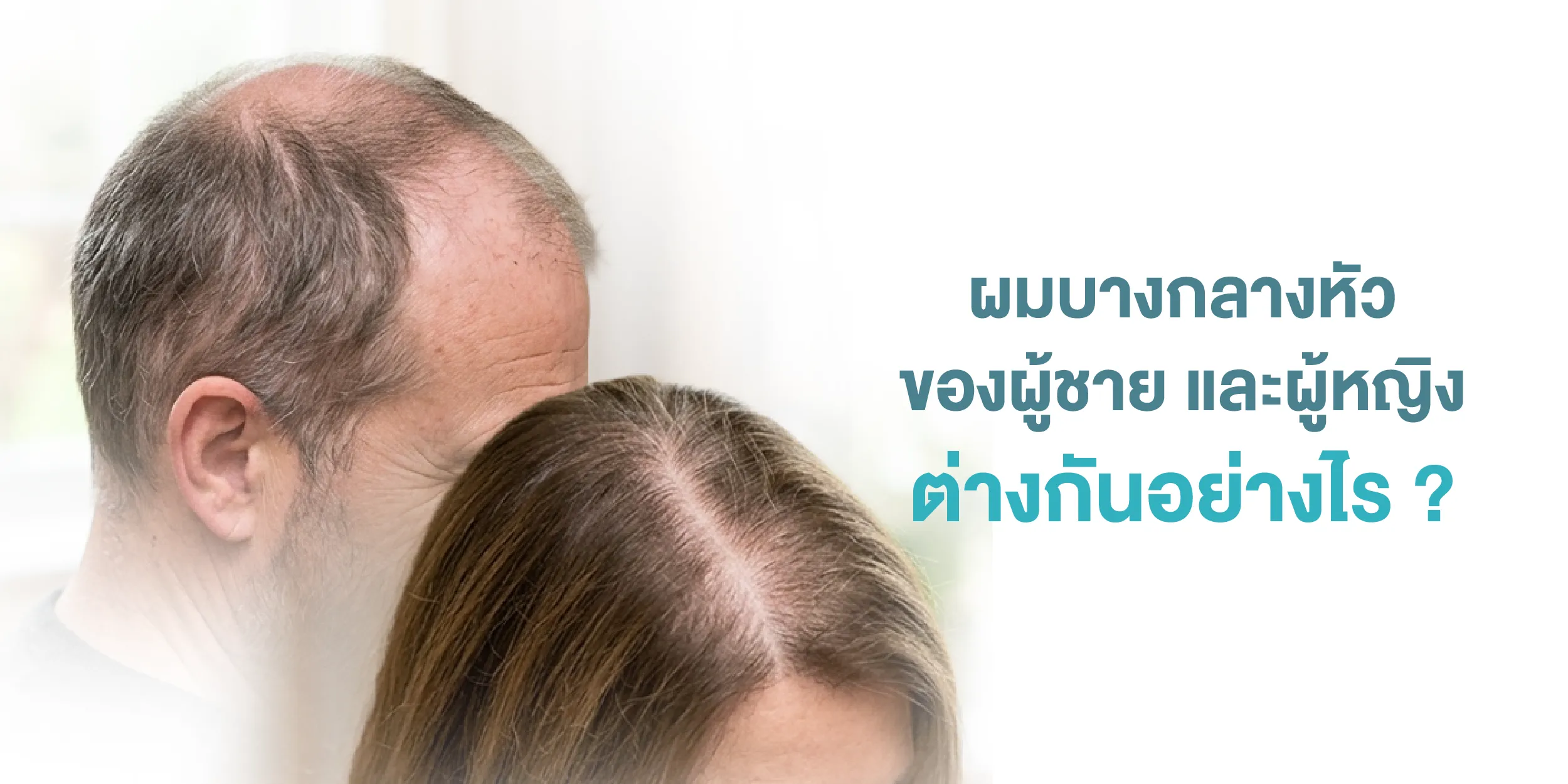 ผมบางกลางหัวของผู้ชาย และผู้หญิง ต่างกันอย่างไร