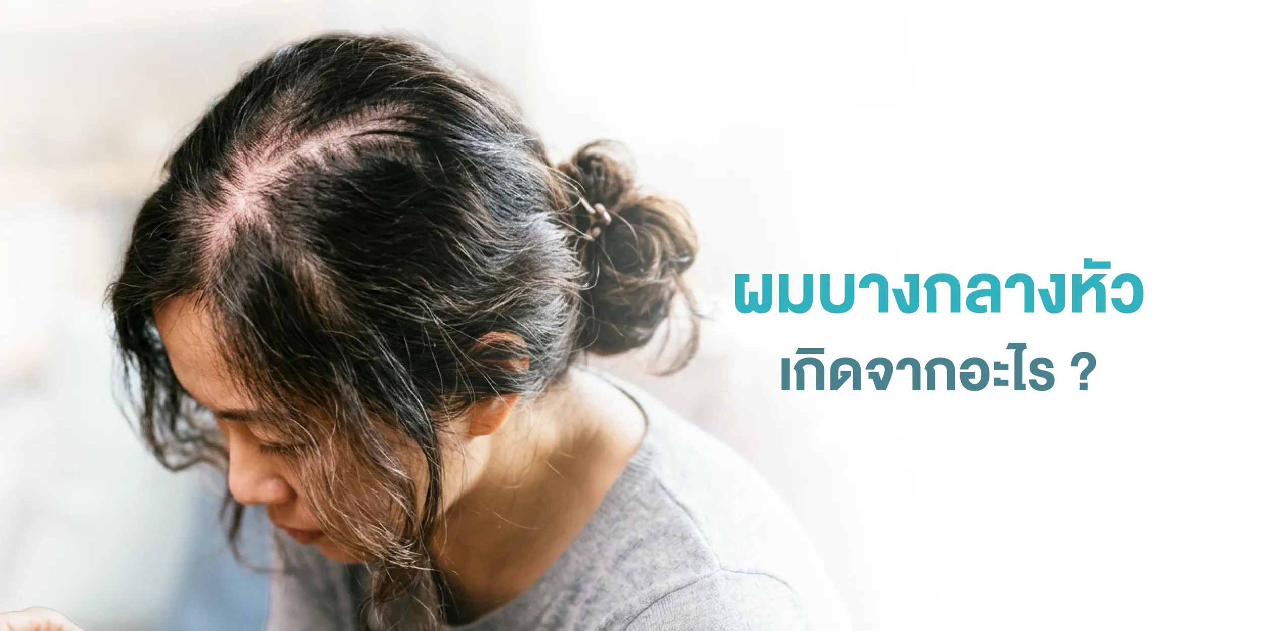 ผมบางกลางหัวเกิดจากอะไร