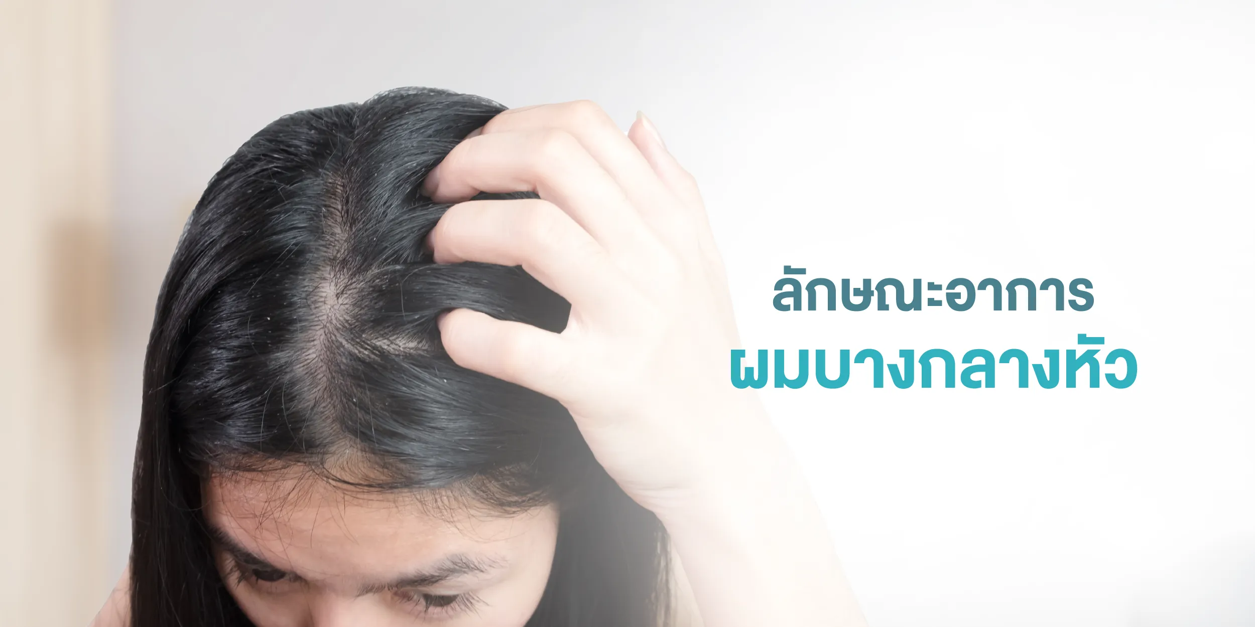 ลักษณะอาการผมบางกลางหัว