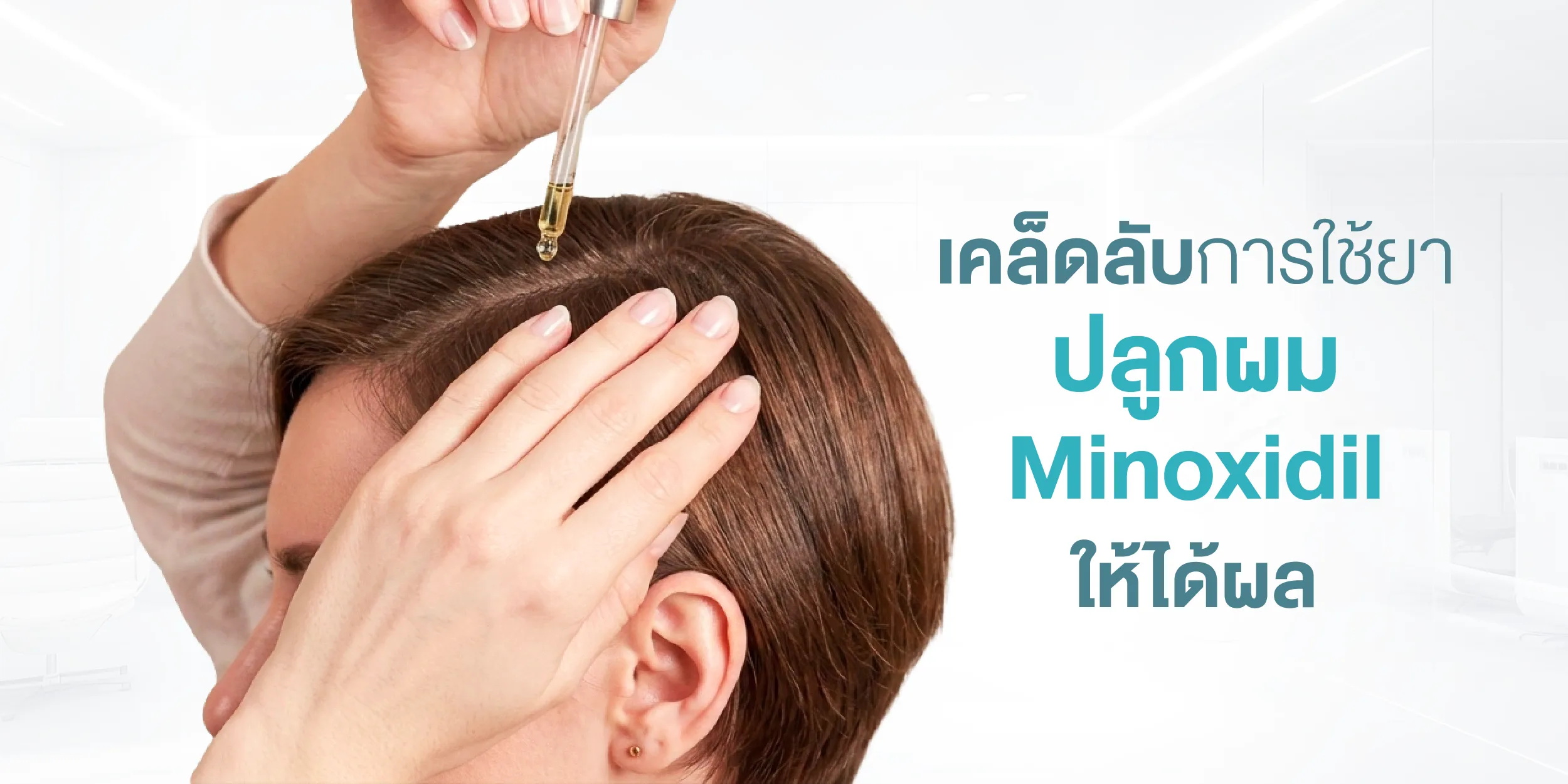 เคล็ดลับการใช้ยาปลูกผม Minoxidil ให้ได้ผล