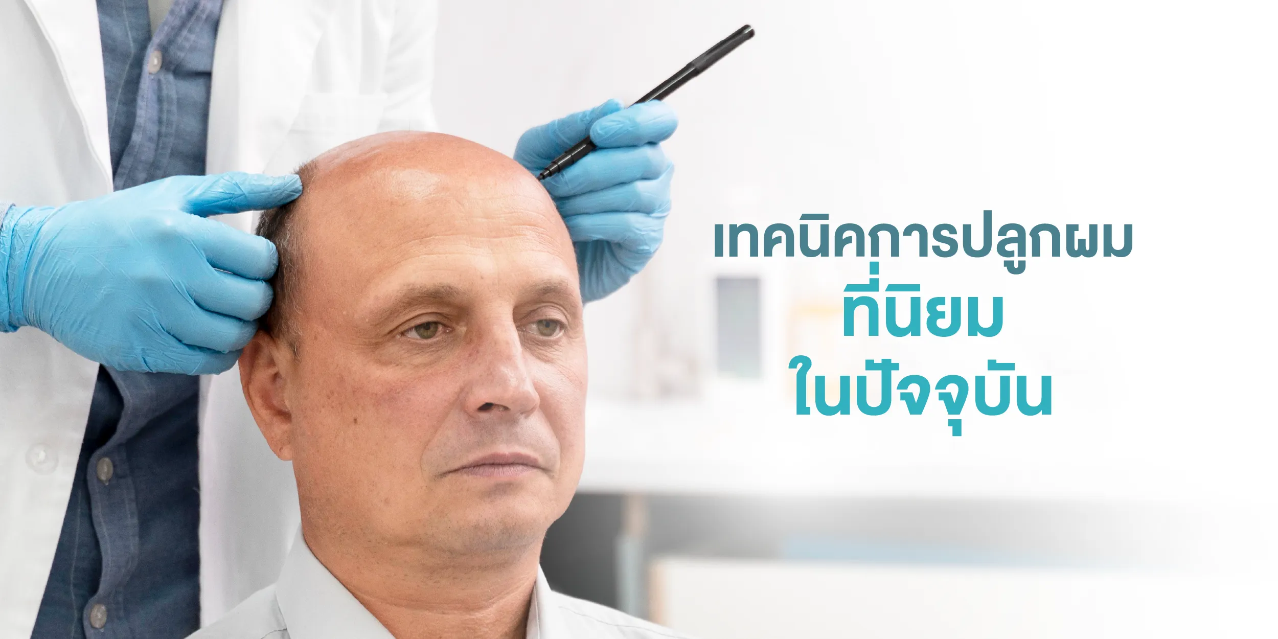เทคนิคการปลูกผมที่นิยมในปัจจุบัน