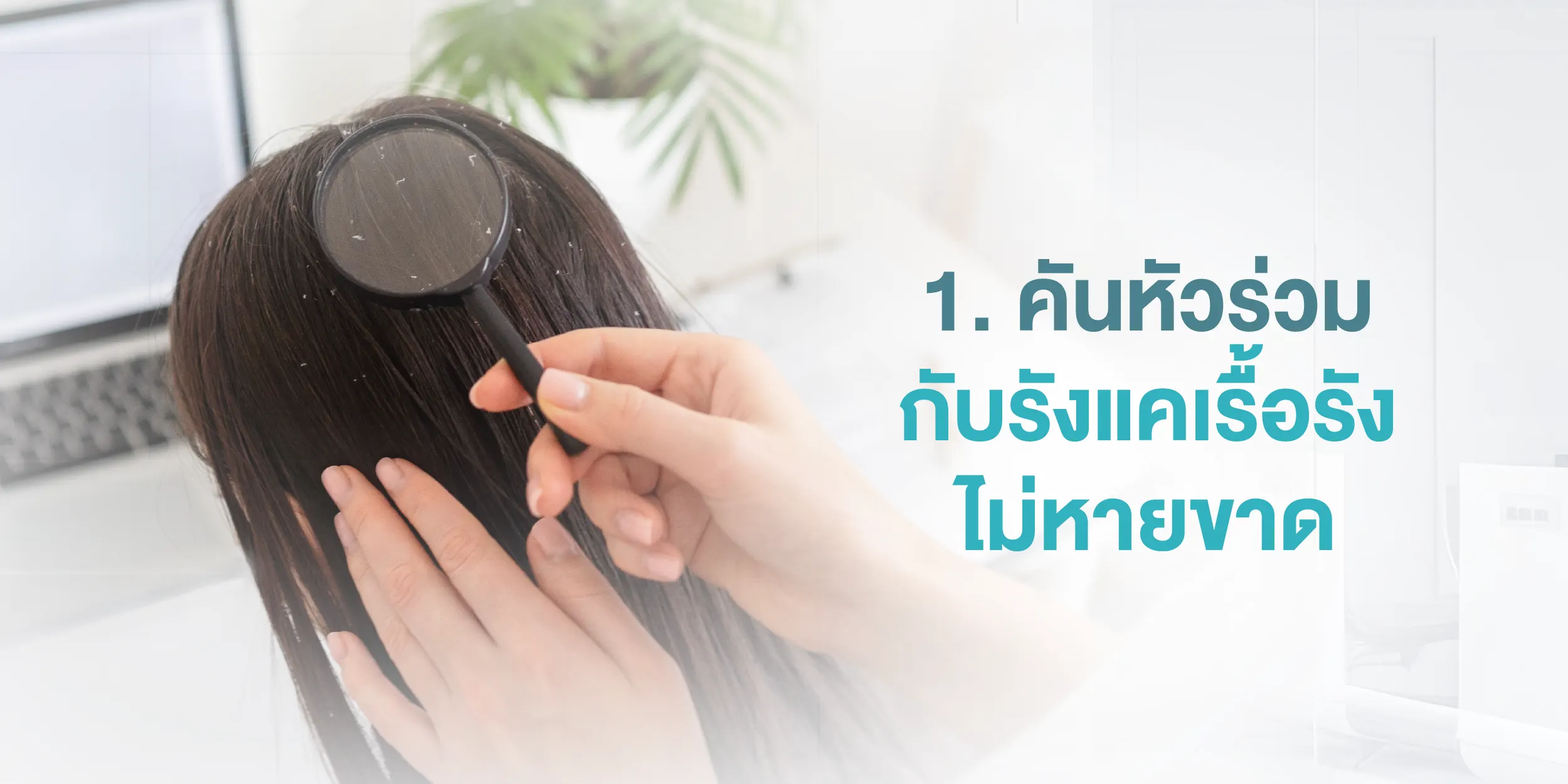 1. คันหัวร่วมกับรังแคเรื้อรัง ไม่หายขาด