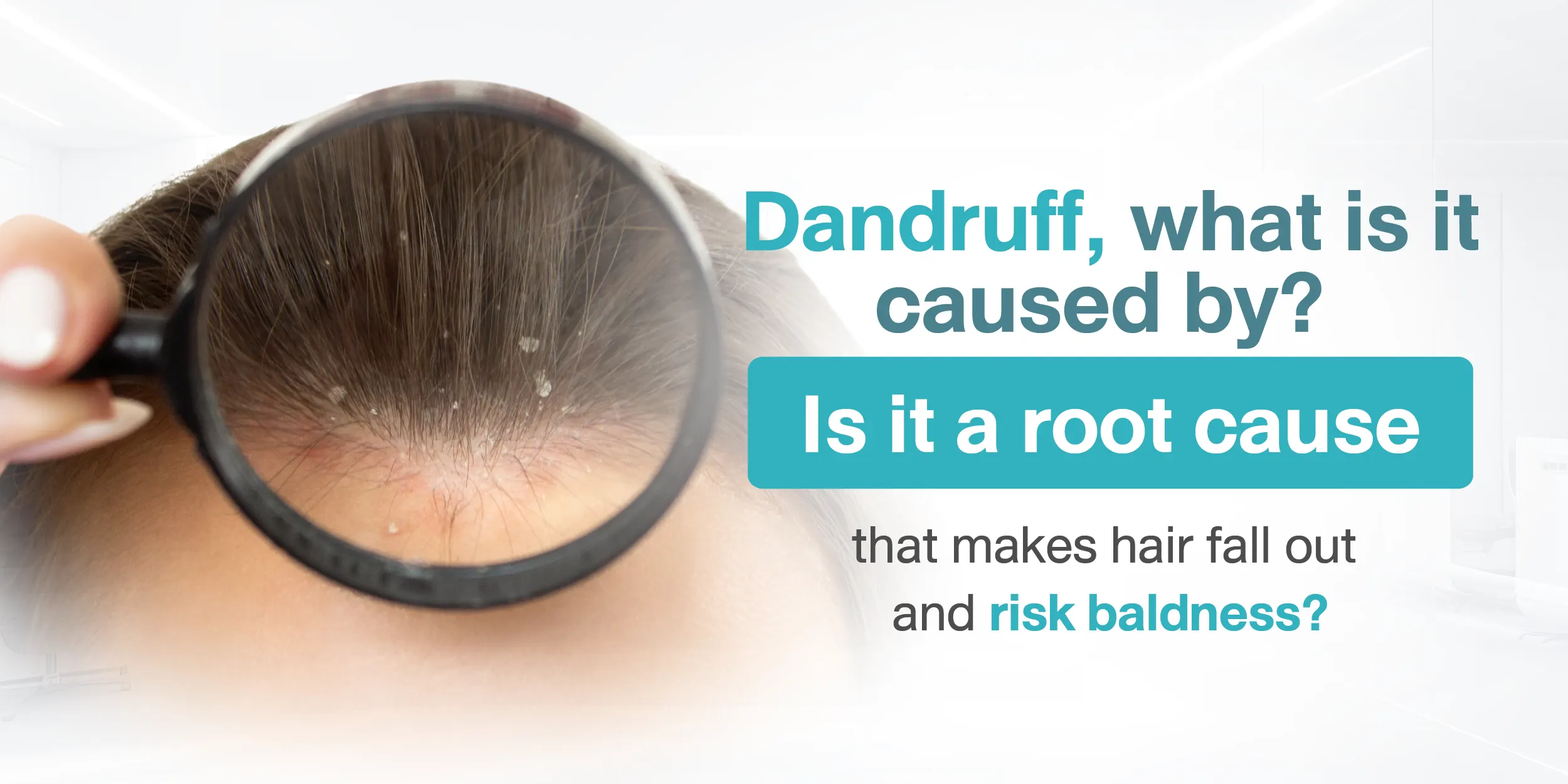 Dandruff, what is it caused by Is it a root cause that makes hair fall out and risk baldness