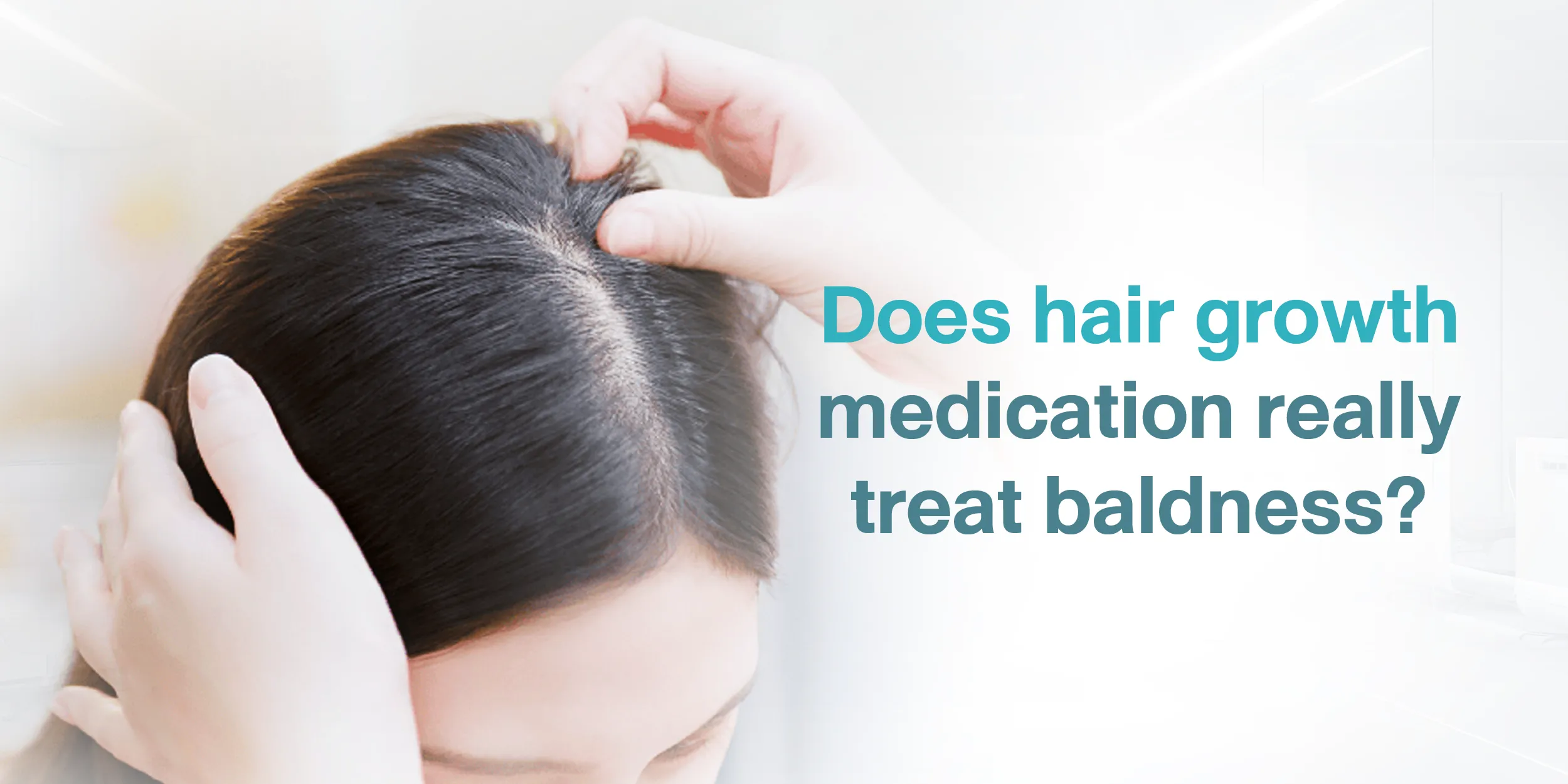 Does hair growth medication really treat baldness