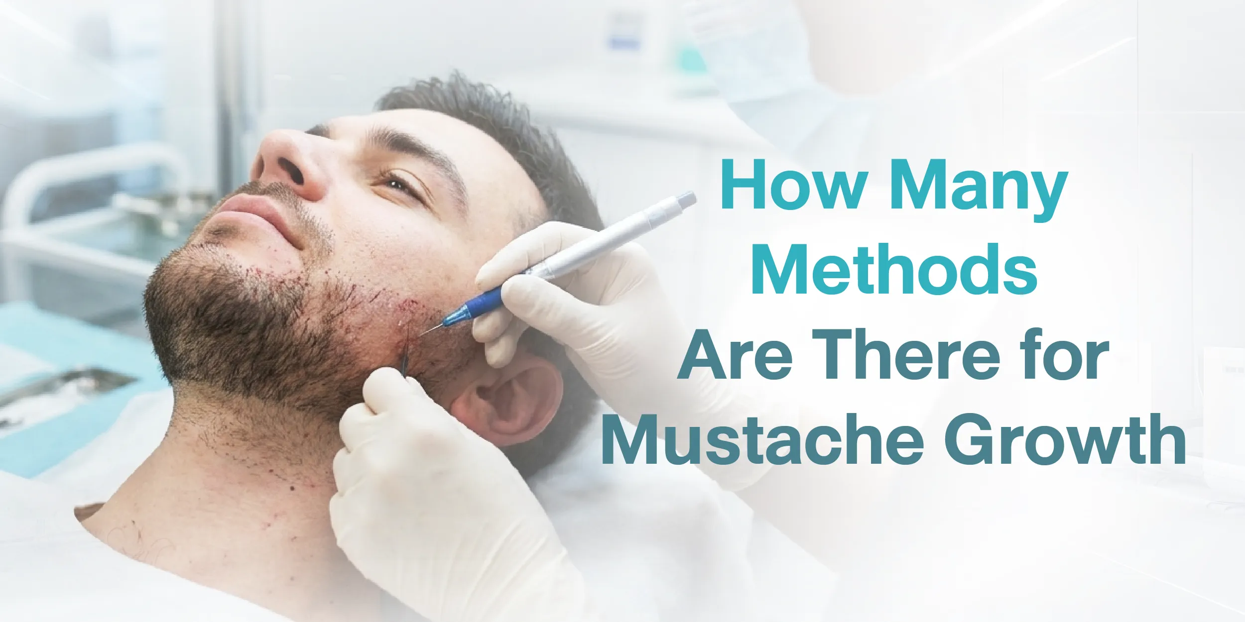 How Many Methods Are There for Mustache Growth