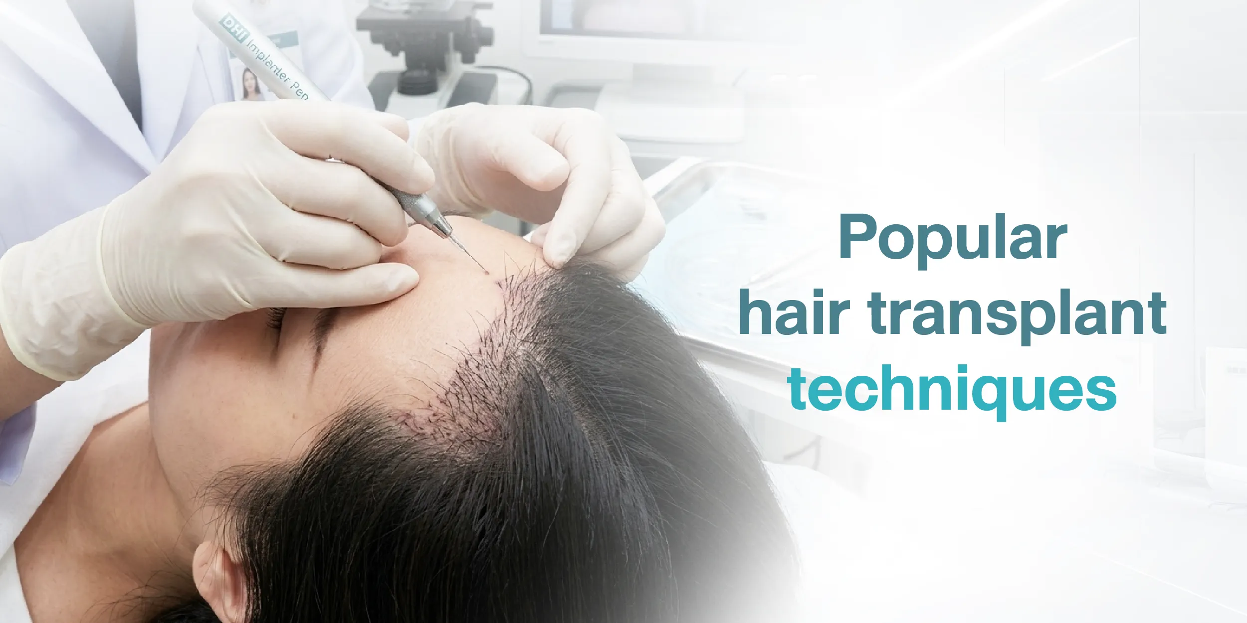 Popular hair transplant techniques